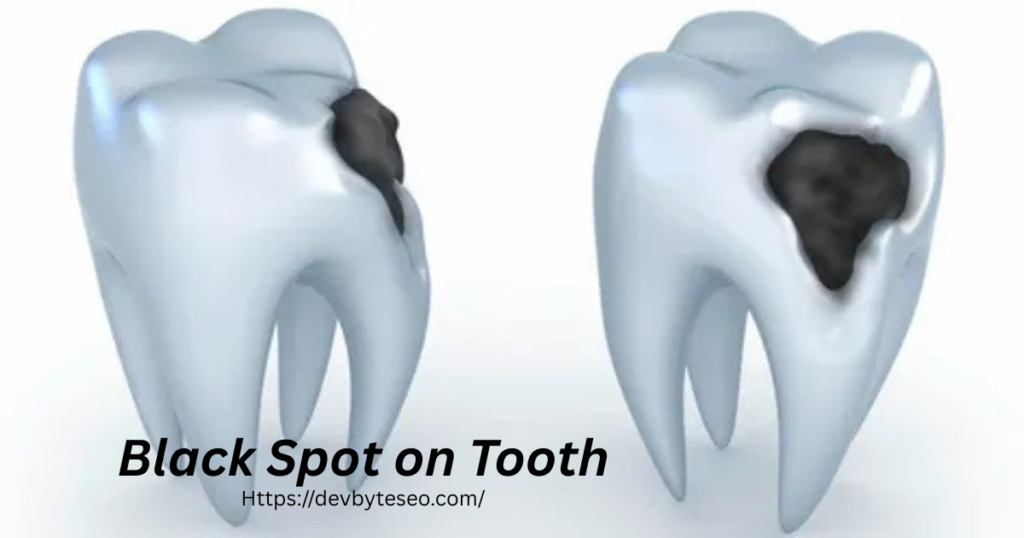 black spot on tooth