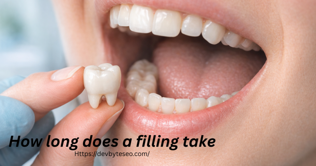 How long does a filling take